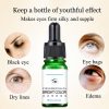 10ML Eye Essential Oil Dark Circles Removes