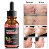 30ml Organic Rosehip Seed Oil Moisturizing Brighten Skin Color