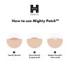 Vegan Acne Pimple Patch Spot Treatment