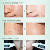 40g Strong Effects Powerful Whitening Freckle Cream Remove Melasma