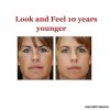 Diamond Microdermabrasion Device USB Rechargeable