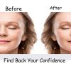 Facial Wrinkle Remover Strips Wrinkle Patches