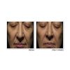 RoC Retinol Correxion Deep Wrinkle Anti-Aging Night Cream | Revitalize Your Skin While You Sleep