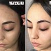 Effective Dark Spot Corrector Cream for Face and Body - Affordable Luxury Under 