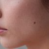 Flash Exfoliation Mineral Peel Face for gentle