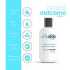 Oily Skin Control Toner For Face by Natural Outcome