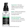 Professional Chemical Face Peel with Retinol