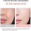 V-Face Shaping Massager Intelligent Face