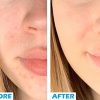 Glow in Seconds with Korean BB Cream – All-in-One Skincare + SPF 30