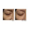 RoC Retinol Correxion Deep Wrinkle Anti-Aging Night Cream | Revitalize Your Skin While You Sleep