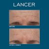 Dr. Lancer Method: Polish for Normal-Combination Skin, 8 FL OZ Bonus Size