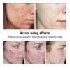 Acne Treatment Serum BREYLEE Tea Tree Oil Clear