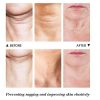 Neck Firming Night Cream For Tightening Lifting Sagging Skin