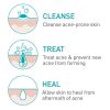 CeraVe Acne Foaming Cream Cleanser