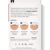 Vegan Acne Pimple Patch Spot Treatment