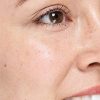 Vegan Acne Pimple Patch Spot Treatment