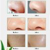 Aloe Vera Extract Facial Mask Anti-Aging