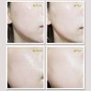 Korean Skin Care Serum for Face, Anti Aging