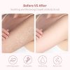 Acne Body Scrub Natural Grapefruit Exfoliating