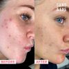 Sand & Sky Flash Perfection Exfoliating Treatment Face Scrub