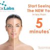 Chamomile and Green Tea Face Peel for Acne Scars
