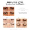 Vita-C Eyes Dark Circle Corrector Dark Circle Eye Treatment