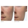 Dr. Dennis Gross Alpha Beta Extra Strength Daily Peel for Oily Skin, Uneven Tone & Wrinkles - 60 Packettes