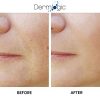 Anti Aging Resurfacing Exfoliate Peel Pads
