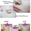 Luxury Korean Facial Treatment Post Procedure Skin Care