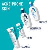 CeraVe Retinol Serum for Post-Acne Marks: Skin Refining Solution - 1 Oz