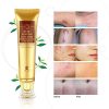 Revitalize Skin with Scar Removal Cream - Stretch Mark Aid and Burns Restore Gel for a Radiant Complexion