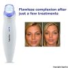 Diamond Microdermabrasion Device USB Rechargeable