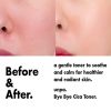 Witch Hazel Korean Face Toner Calming for Dry Oily Skin