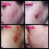 Ultra-Potent Brightening Serum Dark Spot Corrector Remover