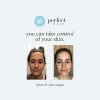 Salicylic Acid Exfoliating Gel Based Peel Prep