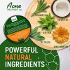 Cystic Acne Treatment and Acne Scar Remover