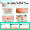 Exfoliating Enzyme Face Mask for Acne and Sensitive Skin