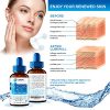 Acne Scars Glycolic Acid Peel 70% - Made in US
