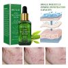 Acne Treatment Serum BREYLEE Tea Tree Oil Clear