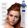 Blackhead Remover Pore Vacuum for face for Whitehead removal