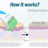 Ice Roller for Face Pain Relief and Minor Injury