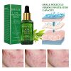Acne Treatment Serum Remover Pimple and Repair Skin