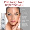 Glycolic Acid Peel - Chemical Peel For Face