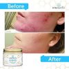 Advanced Moisturizing 12-In-1 Dry Skin Cream
