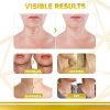 Skin Tightening and Crepe Skin Repair Cream