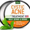Cystic Acne Treatment and Acne Scar Remover