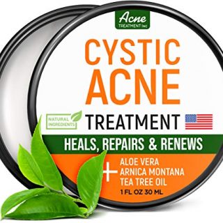 Cystic Acne Treatment and Acne Scar Remover