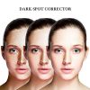 Salicylic Acid Dark Spot Corrector Remover for Face