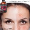 Oil Cold Pressed For Face, Skin, Acne Scars