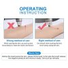 Reveal Radiant Skin with Blackhead Remover Vacuum-Pore Cleaner
